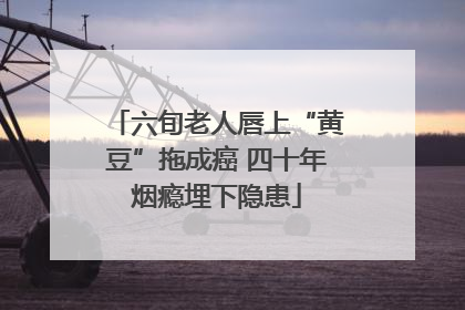 六旬老人唇上“黄豆”拖成癌 四十年烟瘾埋下隐患